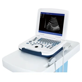 Базовый ультразвуковой сканер для ноутбука, 2D доплеровский ультразвуковой сканер, Китай, портативный ультразвуковой сканер, эхо-оборудование